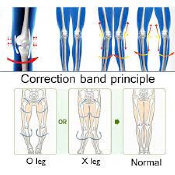 bininbox+o+leg+x+bowed+legs